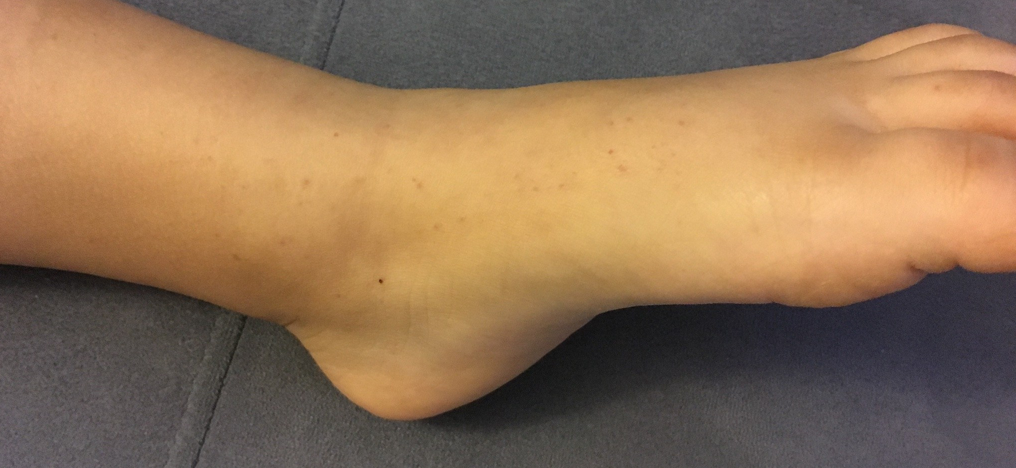 802F2FB9-2C4D-475A-87F2-B36FCB9455B3