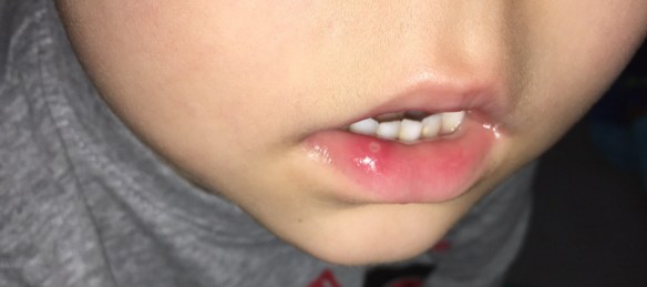 9549FE45-2E9C-4EFD-8B52-9BC899675D0A